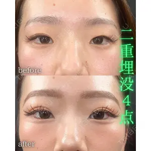 THE FIRST CLINIC 町田院 木暮 啓一郎医師の症例