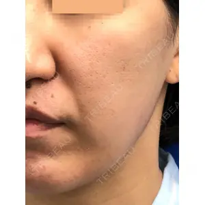MIL CLINIC OSAKA 岩脇 槙佑医師の症例