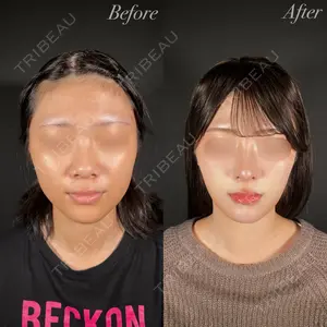 R Beauty CLINIC 大阪院 小池 泰弘医師の症例