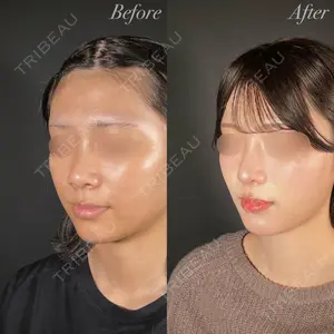 R Beauty CLINIC 大阪院 小池 泰弘医師の症例