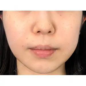 MIL CLINIC OSAKA 岩脇 槙佑医師の症例
