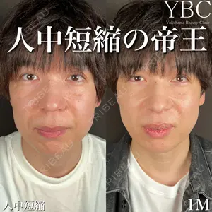 YBC横浜美容外科 大宮院 磯村 亮輔医師の症例