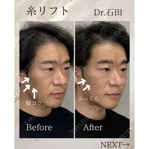 東京美容クリニック 表参道本院 石田 麻佐絵医師の症例