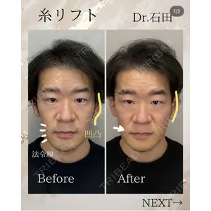東京美容クリニック 表参道本院 石田 麻佐絵医師の症例