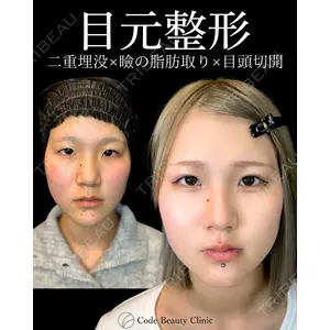 Code Beauty Clinic 名古屋院 橋本 祥平医師の症例
