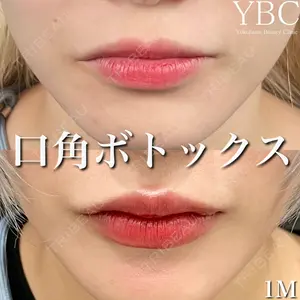 YBC横浜美容外科 大宮院 磯村 亮輔医師の症例