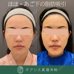 オアシス美容外科 遠藤 剛史医師の症例