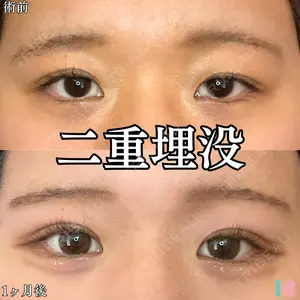 形成外科と美容外科のクリニック池袋 春日 航医師の症例