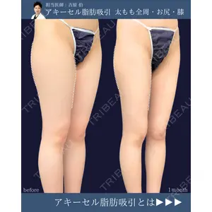 東京シンデレラ美容外科 新宿院 吉原 伯医師の症例