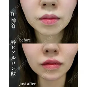 EMMO FACE CLINIC 大阪梅田院 神谷 一成医師の症例