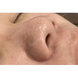 X CLINIC 恵比寿院 辻村 梢医師の症例