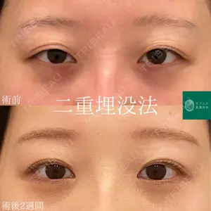 オアシス美容外科 遠藤 剛史医師の症例