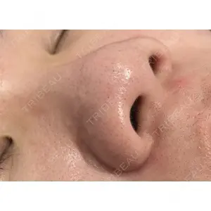 X CLINIC 恵比寿院 辻村 梢医師の症例