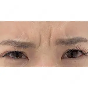X CLINIC 恵比寿院 辻村 梢医師の症例
