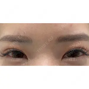 X CLINIC 恵比寿院 辻村 梢医師の症例
