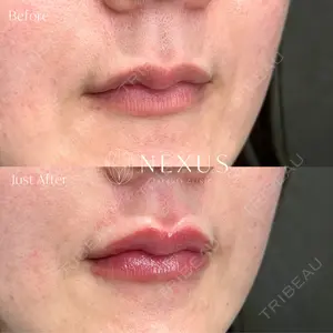 NEXUS CLINIC 渡辺　佳奈医師の症例