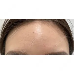 X CLINIC 恵比寿院 辻村 梢医師の症例