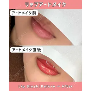 ZiMA CLINIC 森田 佑望医師の症例