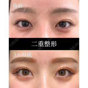 HAAB×DREAM BEAUTY CLINIC 東京本院 田中 優太医師の症例
