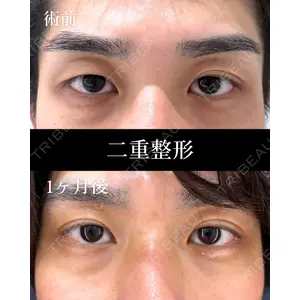 HAAB×DREAM BEAUTY CLINIC 東京本院 萩原 昂医師の症例