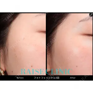 RAISE CLINIC 【レイズクリニック】の症例