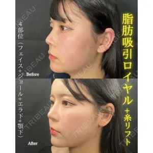 THE FIRST CLINIC 町田院 木暮 啓一郎医師の症例