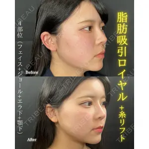 THE FIRST CLINIC 町田院 木暮 啓一郎医師の症例