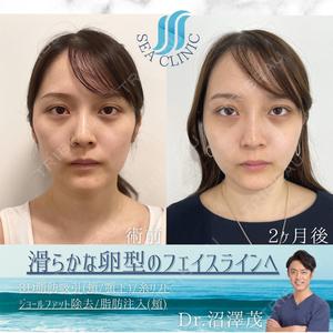 SEA CLINIC（シークリニック） 沼澤 茂医師の症例