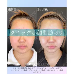 ルラ美容クリニック 札幌院 佐藤 雄紀医師の症例
