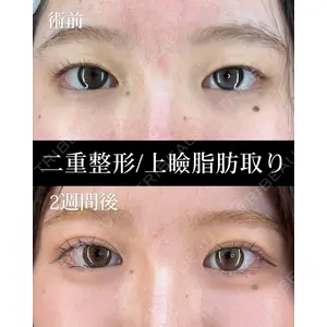 HAAB BEAUTY CLINIC 名古屋院 丸山 舜大医師の症例