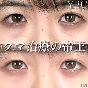 YBC横浜美容外科 大宮院 磯村 亮輔医師の症例