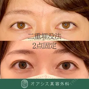 オアシス美容外科 遠藤 剛史医師の症例