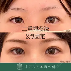 オアシス美容外科 遠藤 剛史医師の症例