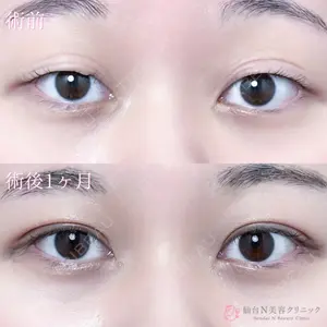 仙台N美容クリニック 小阪 捺稀医師の症例