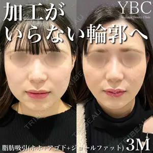 YBC横浜美容外科 大宮院 磯村 亮輔医師の症例
