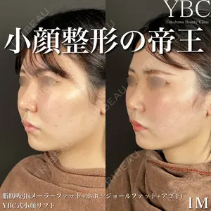 YBC横浜美容外科 大宮院 磯村 亮輔医師の症例