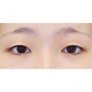 湘南美容クリニック 川崎院 大嶋 美喜子医師の症例