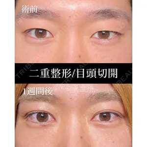 HAAB BEAUTY CLINIC 名古屋院 丸山 舜大医師の症例