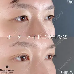 Brandnew Beauty Clinic 平山 容成医師の症例