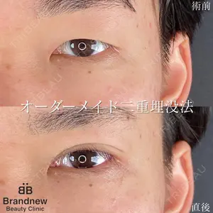 Brandnew Beauty Clinic 平山 容成医師の症例