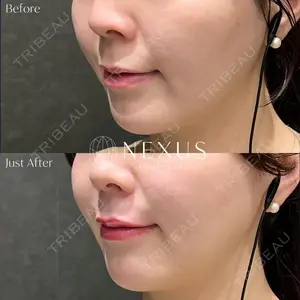 NEXUS CLINIC 河合 朝奈医師の症例
