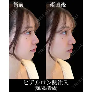 HAAB×DREAM BEAUTY CLINIC 東京本院 佐野 圭医師の症例