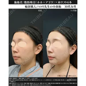 湘南美容クリニック 川崎院 伊藤 賀敏医師の症例