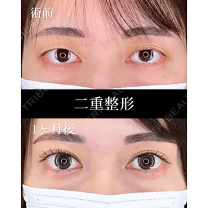 HAAB×DREAM BEAUTY CLINIC 大阪梅田院 柏木 太雅医師の症例