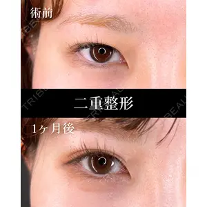 HAAB×DREAM BEAUTY CLINIC 大阪梅田院 柏木 太雅医師の症例