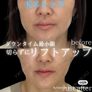 THE FIRST CLINIC 多摩センター院 惟村 公郁医師の症例