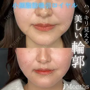 THE FIRST CLINIC 多摩センター院 惟村 公郁医師の症例