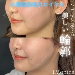 THE FIRST CLINIC 多摩センター院 惟村 公郁医師の症例