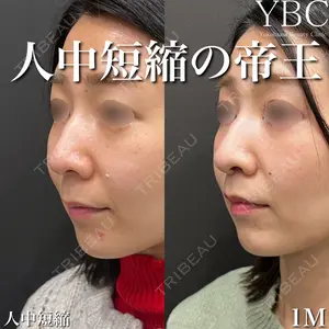 YBC横浜美容外科 大宮院 磯村 亮輔医師の症例
