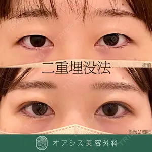 オアシス美容外科 遠藤 剛史医師の症例